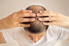 Какая норма выпадения волос в день у мужчин?