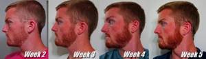 Как ускорить рост бороды на лице: все секреты