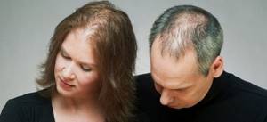Почему выпадают волосы на теле у мужчин: тотальная алопеция или другое?