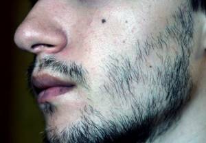 Некрасивые бороды: причины и фото
