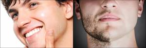 Перхоть в бороде и усах: причины и методы борьбы