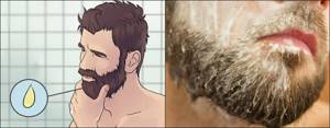 Перхоть в бороде и усах: причины и методы борьбы