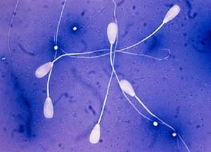 Какого цвета должна быть здоровая сперма?