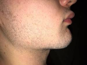 Как отрастить бороду подростку (14-17 лет)