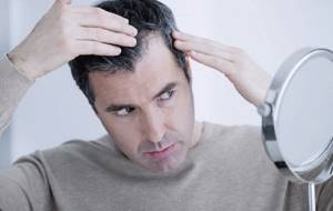 Причины залысин на голове у мужчин: почему выпадают волосы