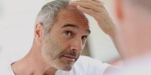 Основные причины выпадения волос у мужчин: устанавливаем диагноз