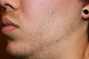 Слишком быстро растет борода: почему и как замедлить?